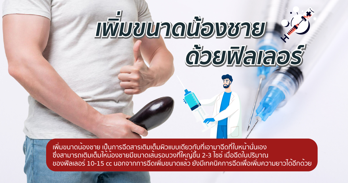 ฟิลเลอร์เพิ่มขนาด