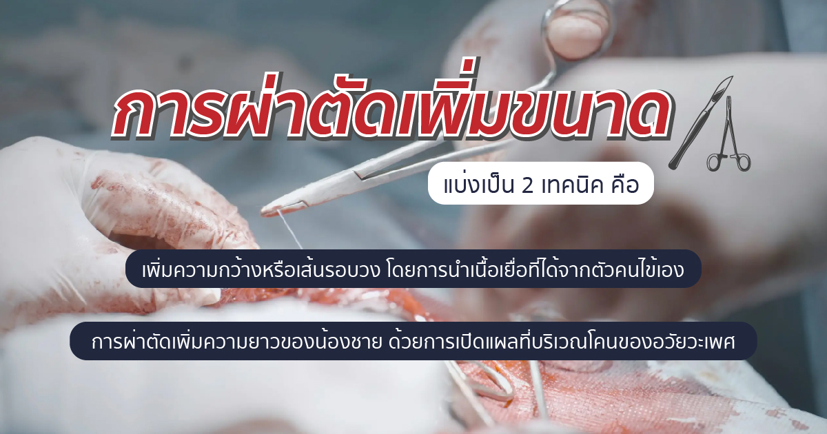 การผ่าตัดเพิ่มขนาด