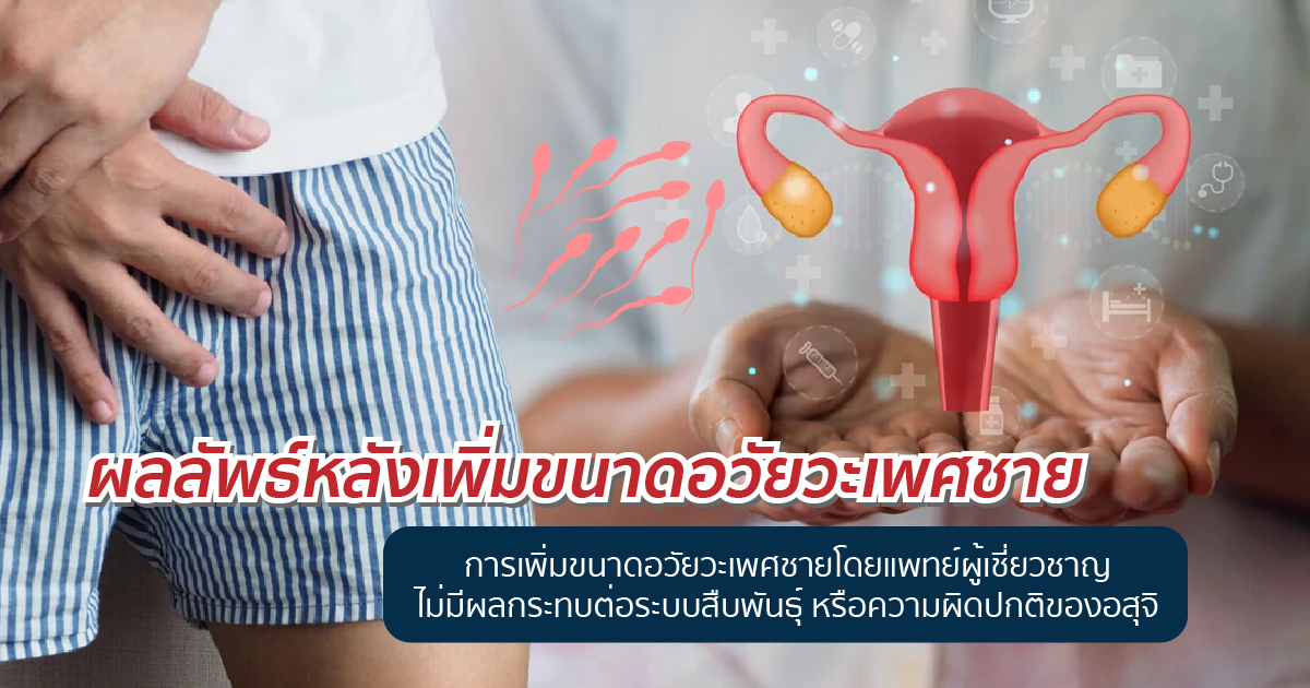 ผลกระทบเพิ่มขนาด