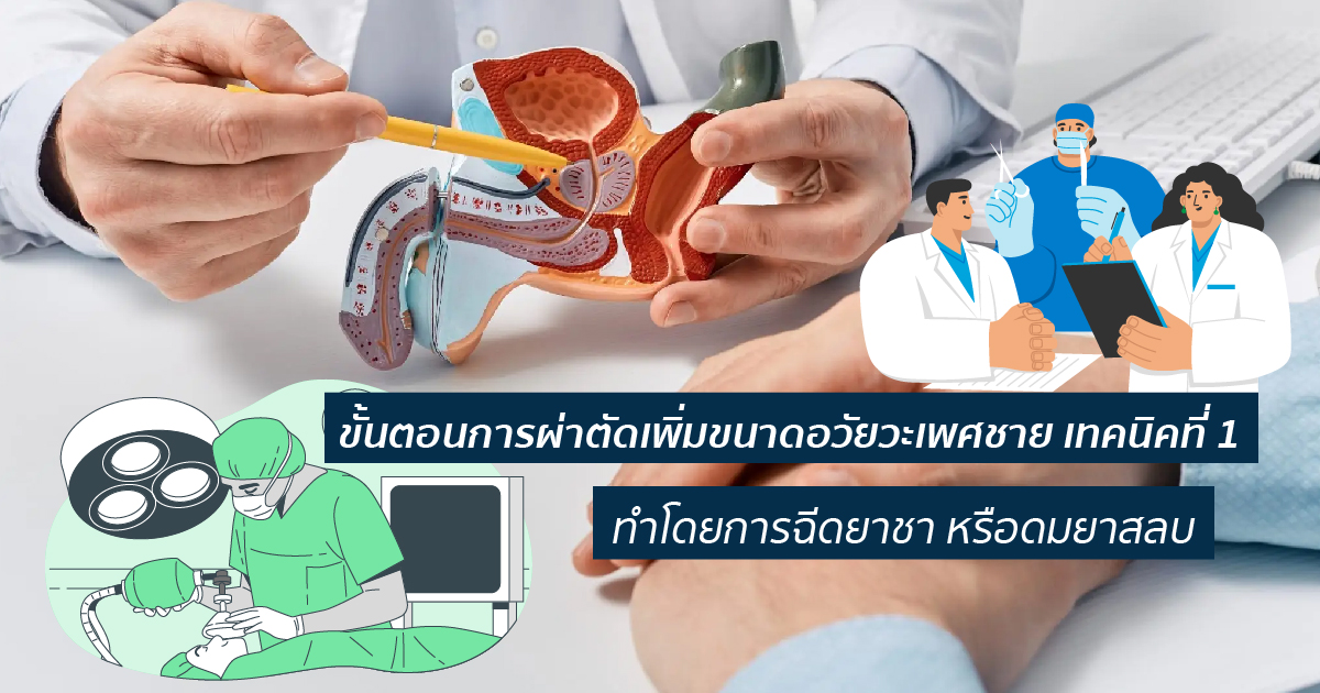 ขั้นตอนการผ่าตัดเพิ่มขนาดอวัยวะเพศชาย 