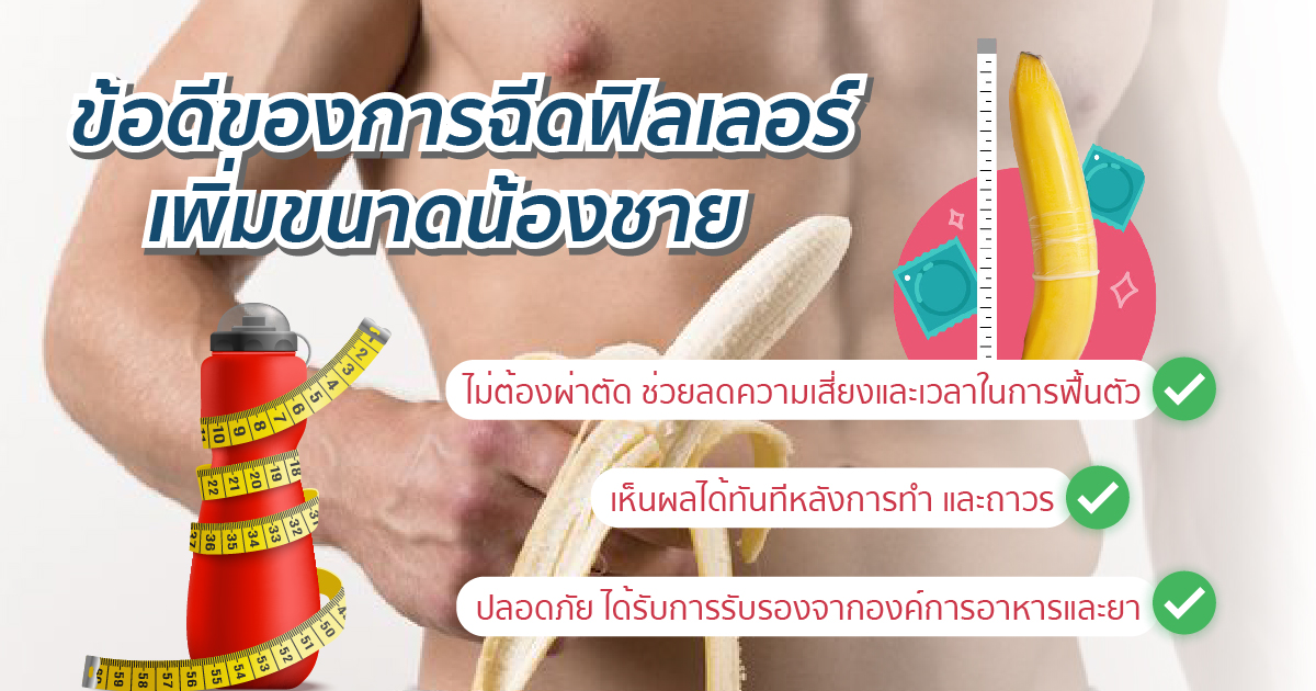 ข้อดีฉีดฟีลเลอร์