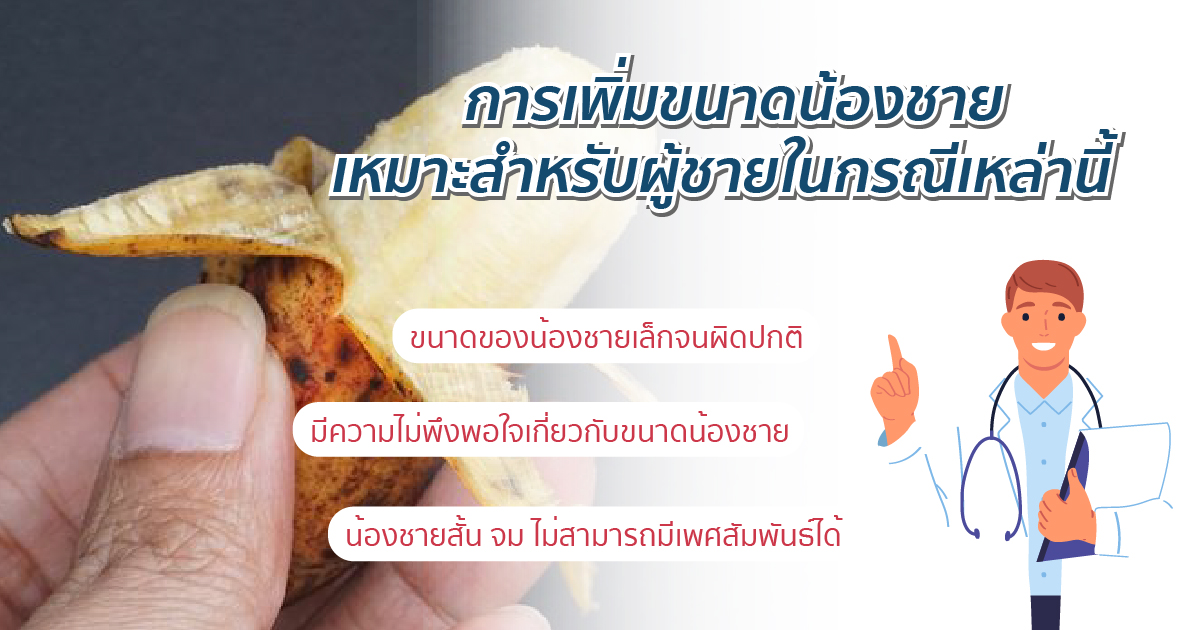 การเพิ่มขนาดน้องชาย